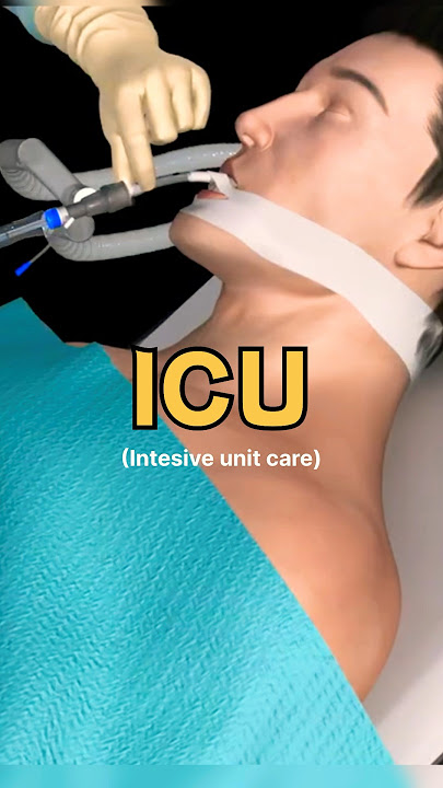 What happens in ICU ?