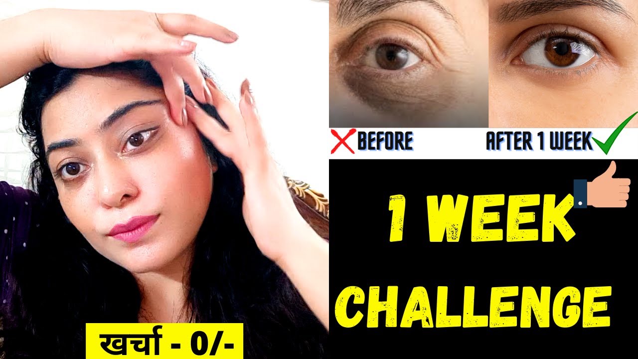 आंखों के नीचे गड्ढे,धंसी हुई आंखें, Dark circles & Wrinkles को 7 दिन में  गायब करने का रामबाण नुस्खा - YouTube