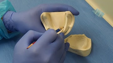 CUSTOM IMPRESSION TRAYS . 1 Cast Marking