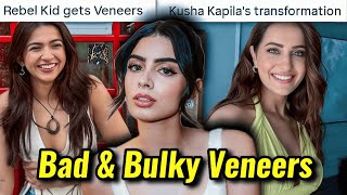 Download Lagu KHUSHI KAPOOR \u0026 REBEL KIDS BULKY VENEERS: KUSHA KAPILA'S SMILE TRANSFORMATION MP3 Download Lagu KHUSHI KAPOOR \u0026 REBEL KIDS BULKY VENEERS: KUSHA KAPILA'S SMILE TRANSFORMATION MP3