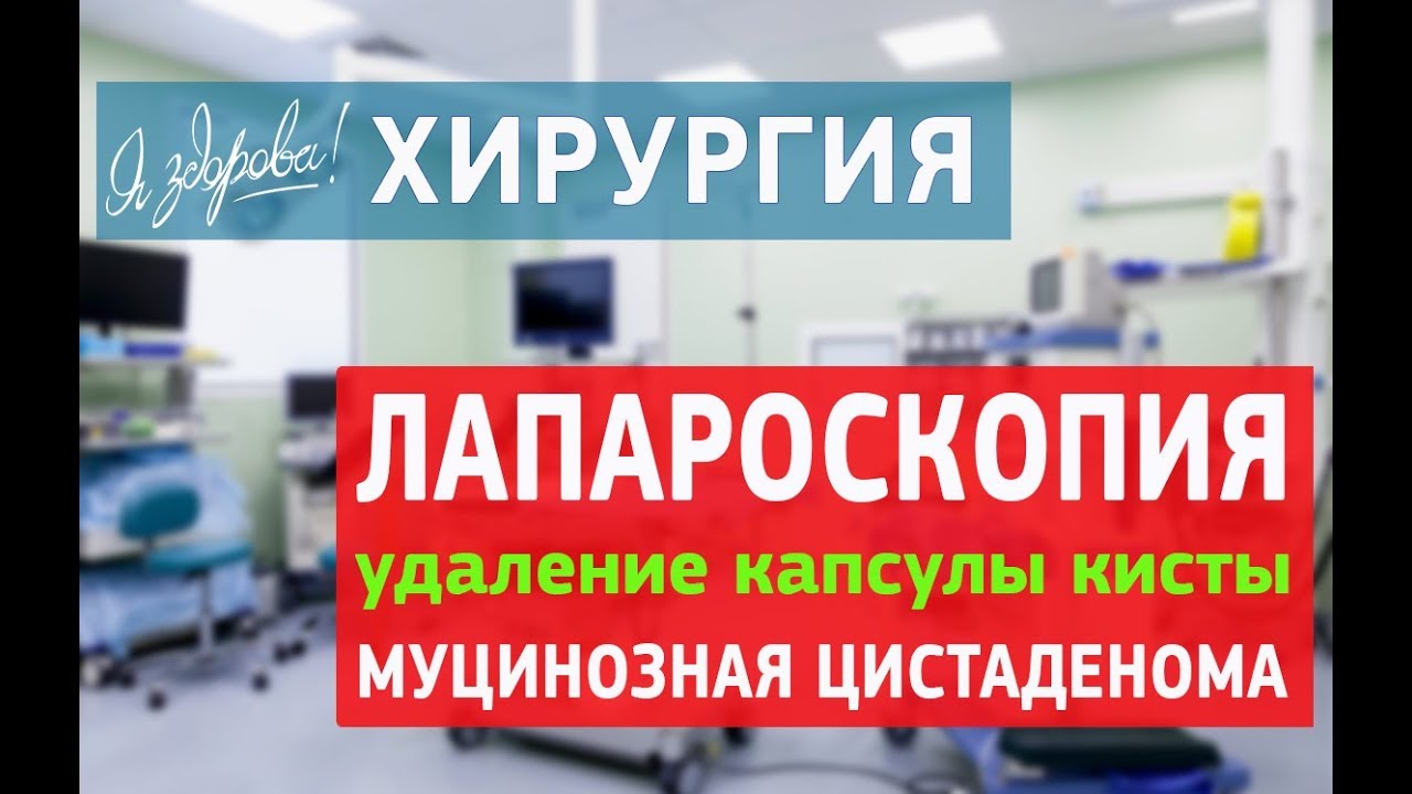 Лапароскопия Удаление капсулы кисты муцинозная цистаденома