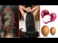 How To Grow Long and Stop Hair Fall With Onion & Egg !! Super Fast Hair Growth Challenge!