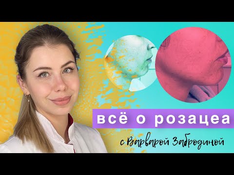 Все о Розацеа (Rosacea) - Доказательная медицина