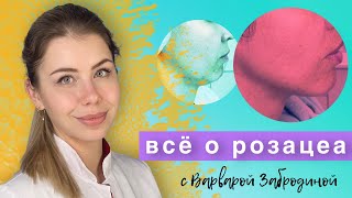 Все о Розацеа (Rosacea) - Доказательная медицина