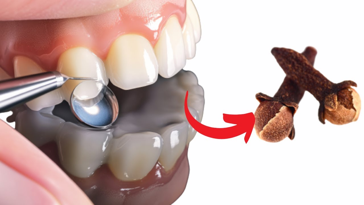 Kit De Secours Contre Le Mal De Dents Croix-Rouge - Avec Eugénol Naturel (0,12 Oz) - Pour Soulagement Temporaire - Neuf - Date Limite 03/2024