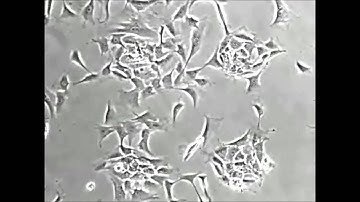 A Molecular Smart Surface for Spatio-Temporal Studies of Cell Mobility