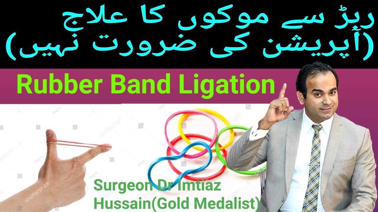 Rubber Band Ligation آپریشن کے بغیر موکۓ کا علاج Non Surgical