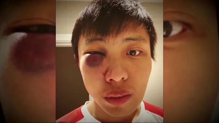 KPIX 5 Betty Yu: Bay Area Efforts to Fight Rising Racism, Attacks on Asians