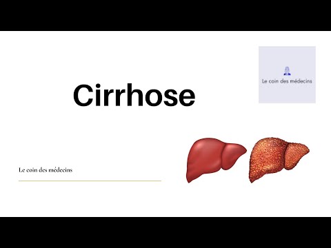 Cirrhose