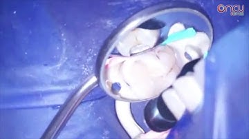 POLYDENTIA | Lumicontrast