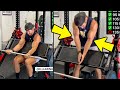 Double Biceps Rupture - Doctor Explains Ultra-Rare Bodybuilding Injury