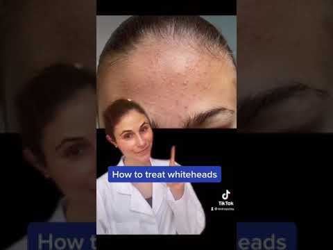 Video: 3 būdai, kaip padaryti garbanas trumpiems plaukams