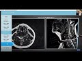 How to View a Spine MRI