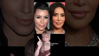 Kylie' new face? #kyliejenner #medicalaesthetics #kylie #botox #celebritynews