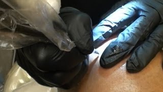 Cure for Baldness?  Hair Tattoos (Cosmetic Transdermal Hair Replication) Available for Men and Women
