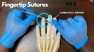 Nailbed Repairs The Ultimate Plastic Surgery Secrets