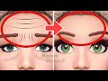 How to reduce forehead wrinkles  frown lines between eyebrows naturally