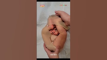 En caul birth | bayi lahir terbungkus ketuban