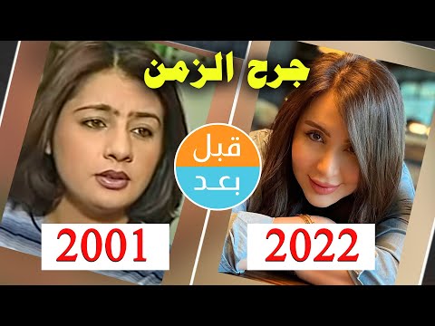 أبطال مسلسل جرح الزمن  بعد  سنة قبل و بعد    