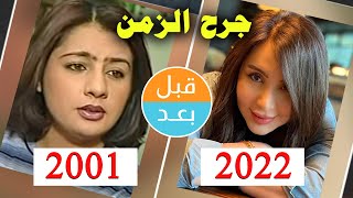 أبطال مسلسل جرح الزمن (2001) بعد 21 سنة .. قبل و بعد 2022 .. before and after
