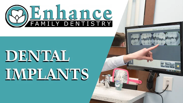 Dental Implants | Dr. Paresh Shrimankar | Enhance ...