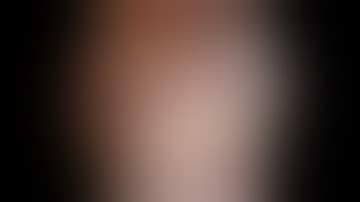 Arthroscopic Double Row Subscapularis Repair