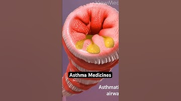 Astmamedicijnen (3D-animatie)