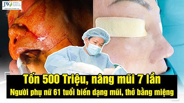 Cà Mau NỔ BIẾN 7 lần SỬA MŨI, 20 năm THỞ BẰNG MIỆNG, người phụ nữ được Bác sĩ Tú Dung cứu sống