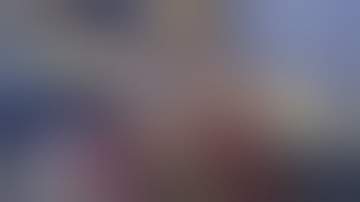 JACK - Left lateral liver resection