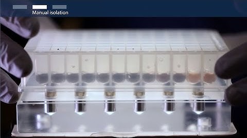 How to Isolate RNA: Total RNA Extraction Protocol for qPCR