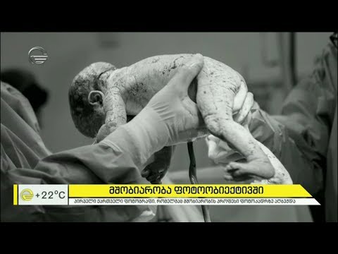 მშობიარობა ფოტოობიექტივში | პირველი ქართველი ფოტოგრაფი, რომელიც მშობიარობას იღებს