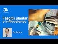 Infiltraciones para la Fascitis Plantar Podología Dr. Iborra