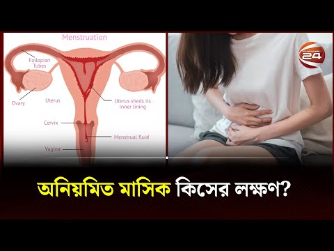 ভিডিও: মজাসিক জার্সি কি আসল?