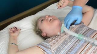 Routine Trach Tube Change