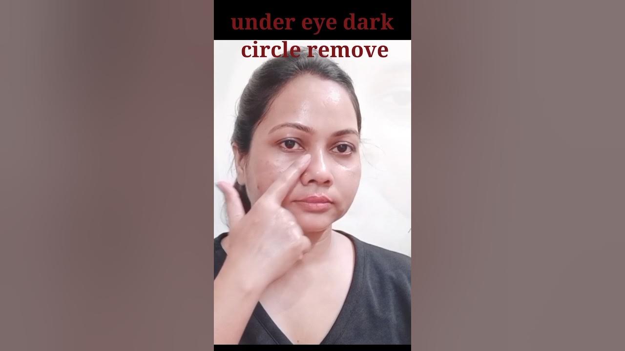 Simple Eye Bags Removal Exercise & Massage You Must Do Eye Wrinkles