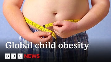 Volgens Unicef ​​zijn er meer kinderen met overgewicht dan met ondergewicht | BBC News