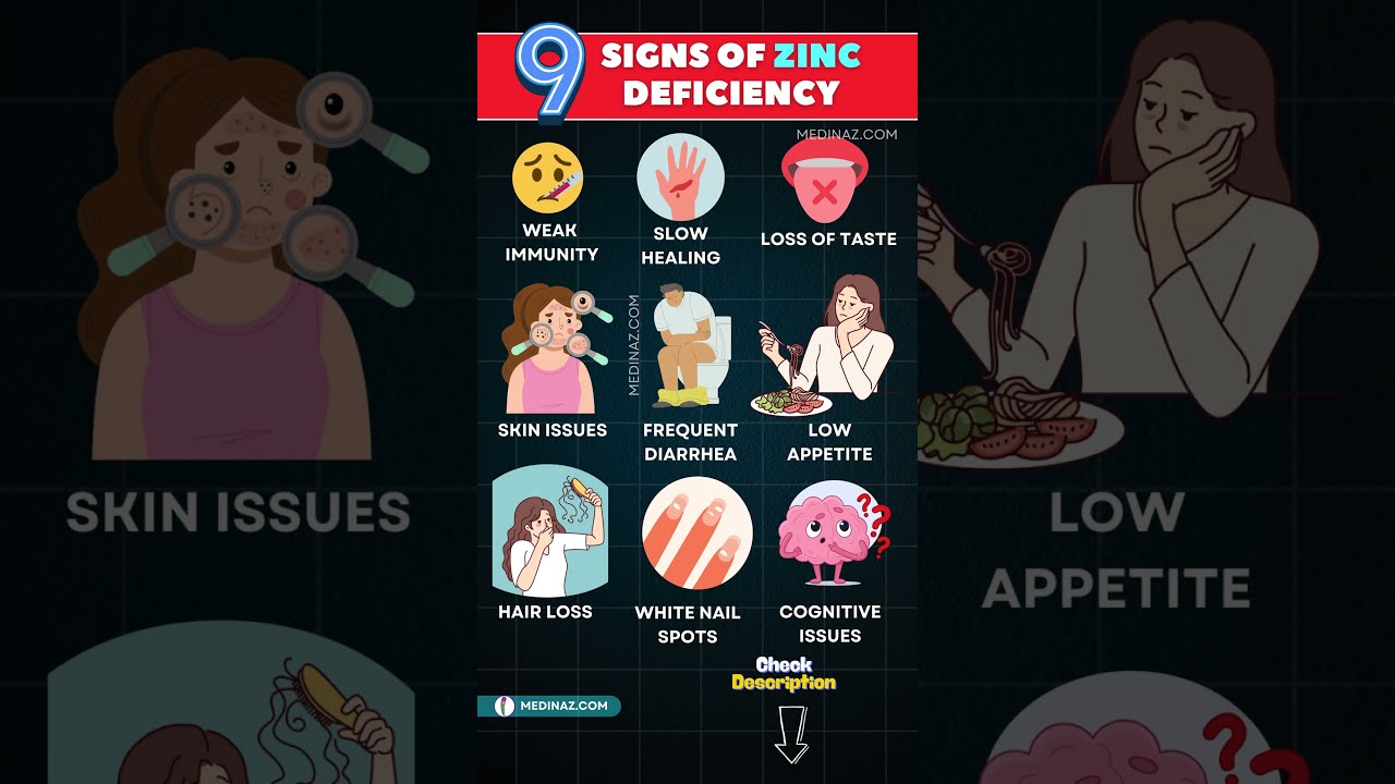 Warning Signs Of Zinc Deficiency You Shouldn T Ignore Shortsfeed Nutrition Health