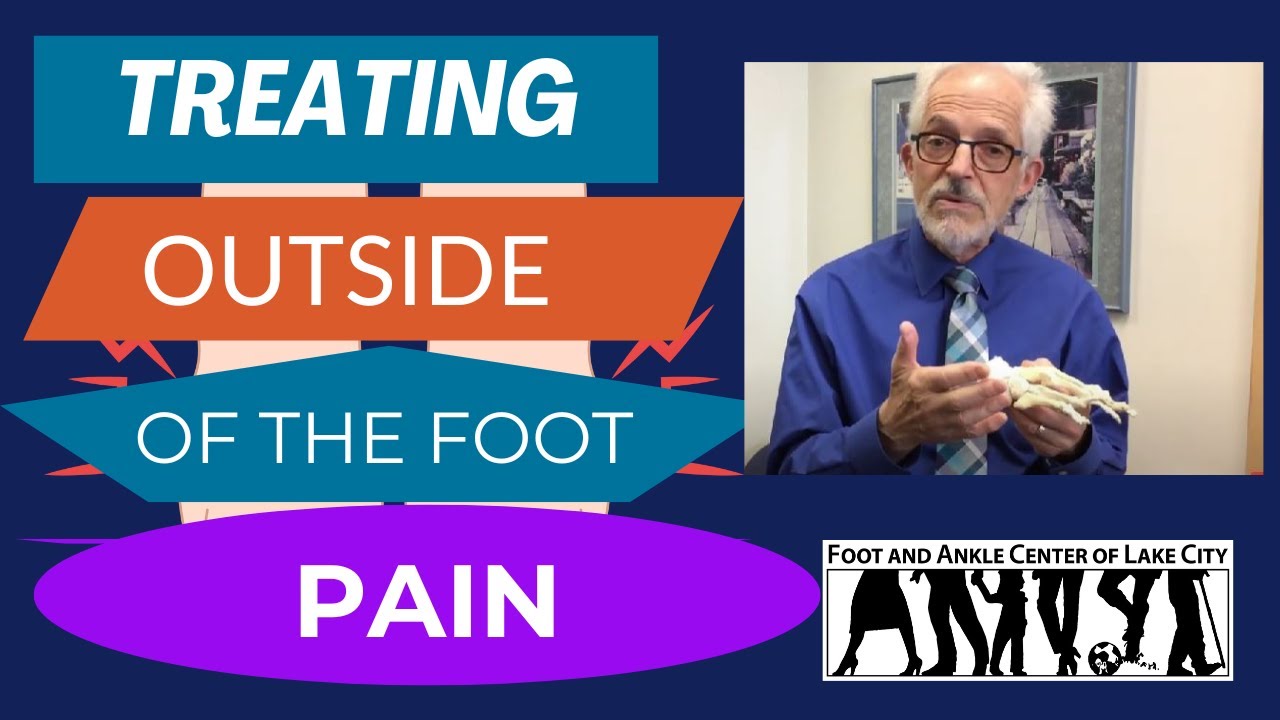 Plantar fascia tear: How to manage - Sport Doctor London