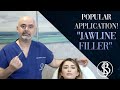 Populer Application Jawline Filler  | Salih Onur Basat M.D