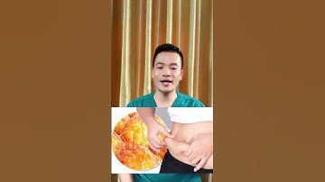 Tại Sao Vòng Bụng To Ra Thì Vòng Đời Ngắn Lại | Đào Ngọc Anh #short #shorts #daongocanh