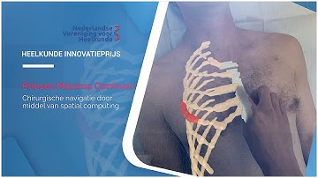 Innovatieprijs 2025 - Chirurgische navigatie met behulp van spatial computing
