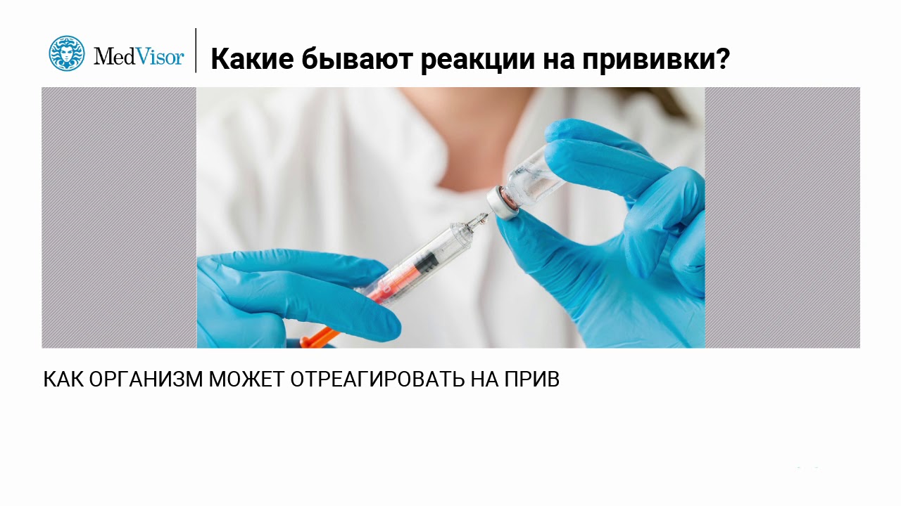 Реакция на прививку форум. Какие бывают реакции на вакцинацию. Какие бывают реакции на прививки. Легкая реакция на вакцину. Необычная реакция на прививку.