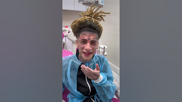 Island boys missing teeth 🦷 😂