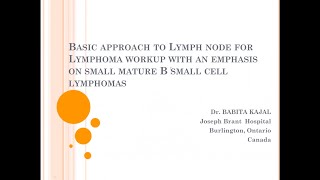 LG PathLab webinars: Basic Approach To Lymph Node For Lymphoma (Small Mature B Small Cell)