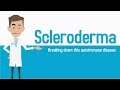 An Overview of Scleroderma Part 1: Breaking it down