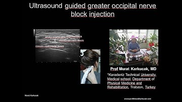 Ultrasound guided greater occipital nerve block injection