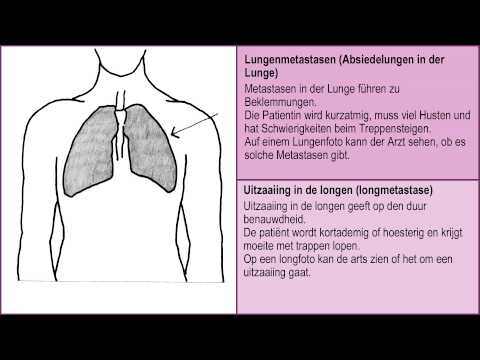 Wenn man nicht mehr gesund wird - Metastasen in Knochen, Lunge, Leber und Gehirn 2/6.