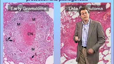 John McKinney (EPFL) Part 1: Tuberculosis a Persistent Threat