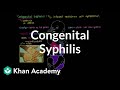Congenital Syphilis Quiz
