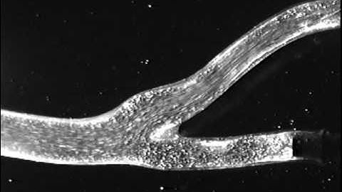 Flow visualization of a carotid artery bifurcation